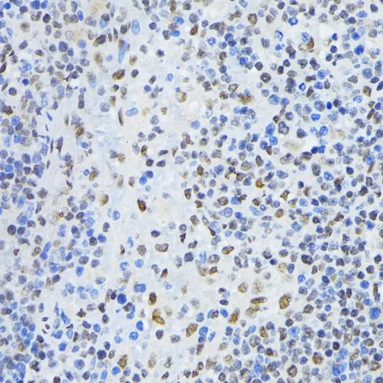 IHC-P analysis of rat spleen tissue using GTX54619 PTBP1 antibody. Dilution : 1:100
