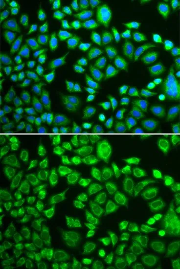 ICC/IF analysis of MCF7 cells using GTX54625 PSMD7 antibody. Blue : DAPI