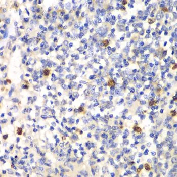 IHC-P analysis of mouse spleen tissue using GTX54625 PSMD7 antibody. Dilution : 1:100