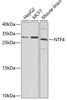 WB analysis of various sample lysates using GTX54627 Neurotrophin 4 antibody. The signal was developed with ECL plus-Enhanced. Dilution : 1:300 Loading : 25microg per lane WB analysis of various sample lysates using GTX54627 Neurotrophin 4 antibody. The signal was developed with ECL plus-Enhanced. Dilution : 1:300 Loading : 25microg per lane