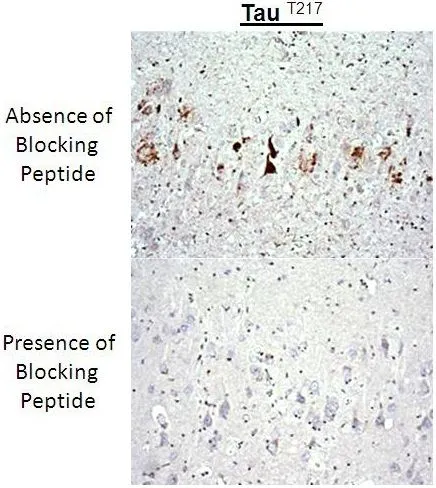 IHC analysis of brain tissues using Tau (phospho Thr217) antibody in the absence or presence of blocking peptide. IHC analysis of brain tissues using Tau (phospho Thr217) antibody in the absence or presence of blocking peptide.