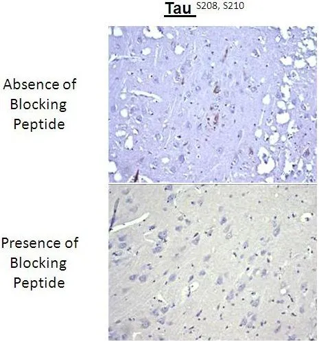IHC analysis of brain tissues using Tau (phospho Ser208/210) antibody in the absence or presence of blocking peptide.