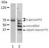 WB analysis of lysates (200microg) from (1) serum-stimulated bovine endothelial cells and (2) HeLa cells using YY1 antibody.