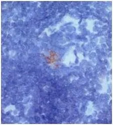 IHC analysis of mouse thymus using Dectin-2 antibody. IHC analysis of mouse thymus using Dectin-2 antibody.