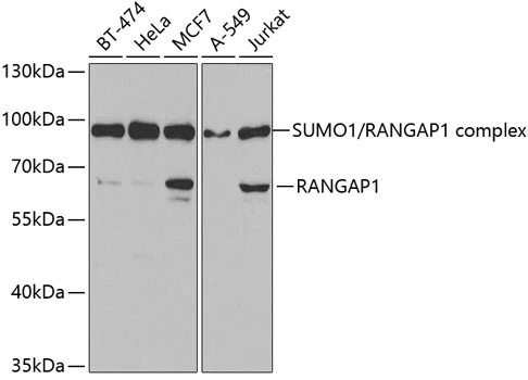WB analysis of various sample lysates using GTX54667 RanGAP1 antibody. Dilution : 1:1000 Loading : 25microg per lane WB analysis of various sample lysates using GTX54667 RanGAP1 antibody. Dilution : 1:1000 Loading : 25microg per lane