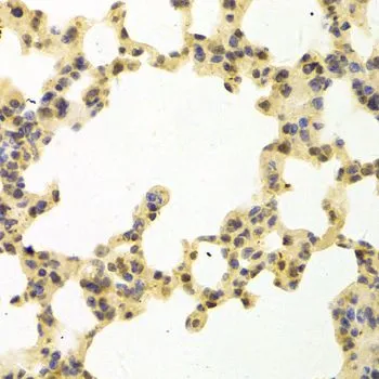 IHC-P analysis of mouse lung tissue using GTX54667 RanGAP1 antibody. Dilution : 1:100