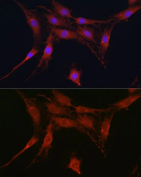 ICC/IF analysis of C6 cells using GTX54676 SLC4A4 antibody. Blue : DAPI Dilution : 1:100
