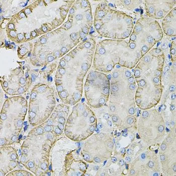 IHC-P analysis of mouse kidney tissue using GTX54676 SLC4A4 antibody. Dilution : 1:100