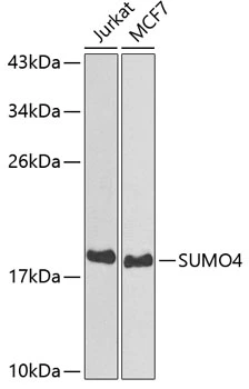 WB analysis of various sample lysates using GTX54685 SUMO4 antibody. Dilution : 1:800 Loading : 25microg per lane WB analysis of various sample lysates using GTX54685 SUMO4 antibody. Dilution : 1:800 Loading : 25microg per lane