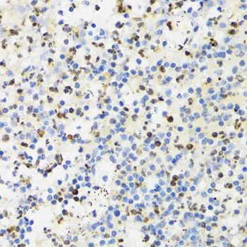 IHC-P analysis of human appendicitis tissue using GTX54685 SUMO4 antibody. Dilution : 1:100
