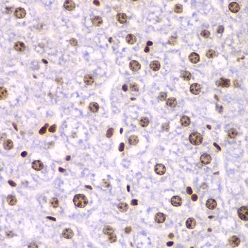 IHC-P analysis of mouse liver tissue using GTX54690 SSRP1 antibody. Dilution : 1:200