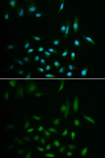 ICC/IF analysis of A549 cells using GTX54706 SUMO3 antibody. Blue : DAPI