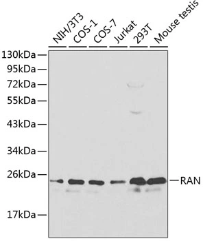 WB analysis of various sample lysates using GTX54708 RAN antibody. Dilution : 1:1000 Loading : 25microg per lane WB analysis of various sample lysates using GTX54708 RAN antibody. Dilution : 1:1000 Loading : 25microg per lane