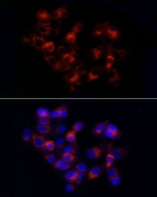 ICC/IF analysis of HepG2 cells using GTX54713 alpha 1 Antitrypsin antibody. Orange : Primary antibody Blue : DAPI Dilution : 1:50