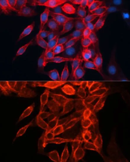 ICC/IF analysis of HeLa cells using GTX54716 CD98 antibody. Blue : DAPI Dilution : 1:100
