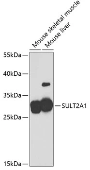 WB analysis of various sample lysates using GTX54718 SULT2A1 antibody. Dilution : 1:2000 Loading : 25microg per lane