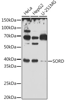 WB analysis of various sample lysates using GTX54728 Sorbitol Dehydrogenase antibody. Dilution : 1:500 Loading : 25microg per lane WB analysis of various sample lysates using GTX54728 Sorbitol Dehydrogenase antibody. Dilution : 1:500 Loading : 25microg per lane