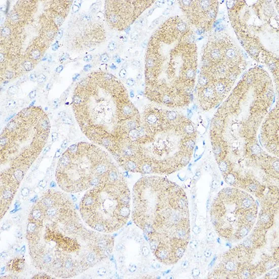 IHC-P analysis of mouse kidney tissue using GTX54728 Sorbitol Dehydrogenase antibody. Dilution : 1:25