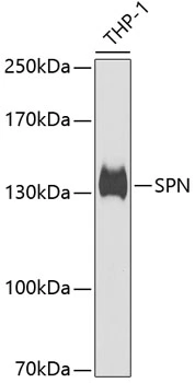 WB analysis of THP-1 cell lysate using GTX54729 CD43 antibody. Dilution : 1:1000 Loading : 25microg per lane WB analysis of THP-1 cell lysate using GTX54729 CD43 antibody. Dilution : 1:1000 Loading : 25microg per lane