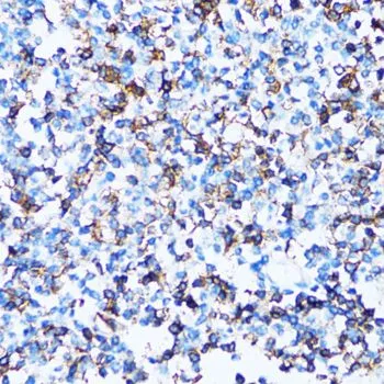 IHC-P analysis of human tonsil tissue using GTX54729 CD43 antibody. Dilution : 1:100