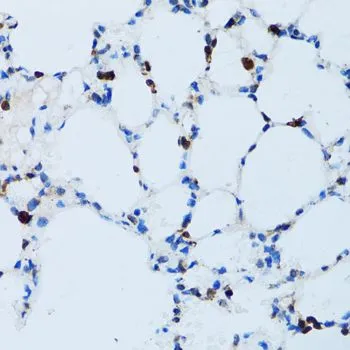 IHC-P analysis of mouse lung tissue using GTX54729 CD43 antibody. Dilution : 1:100