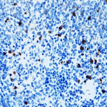 IHC-P analysis of mouse spleen tissue using GTX54729 CD43 antibody. Dilution : 1:100