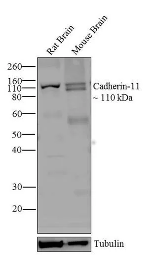 WB analysis of MDA-MB231 cell lysate using GTX54742 CDH11 antibody [5B2H5].