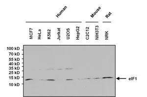 WB analysis of 80microg whole cell lysate using GTX54748 eIF1 antibody [2B9]. Dilution : 1:1000