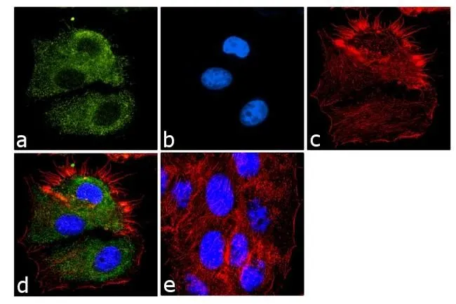 ICC/IF analysis of MCF-7 cells using GTX54748 eIF1 antibody [2B9]. Panel e is a no primary antibody control. Green : Primary antibody Blue : Nuclei Red : Actin Fixation : 4% paraformaldehyde Permeabilization : 0.1% Triton? X-100 for 10 minutes Dilution : 2 microg/ml in 0.1% BSA and incubated for 3 hours at room temperature