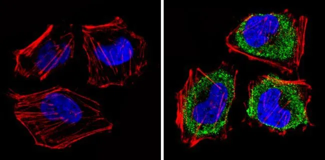 ICC/IF analysis of HeLa cells using GTX54748 eIF1 antibody [2B9]. Cells were probed without (left) or with(right) an antibody. Green : Primary antibody Blue : Nuclei Red : Actin Fixation : Formalin Permeabilization : 0.1% Triton X-100 in TBS for 5-10 minute Dilution : 1:200 incubated overnight at 4 oC