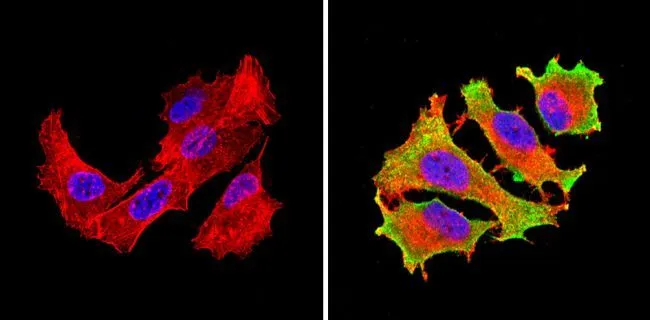 ICC/IF analysis of MCF-7 cells using GTX54748 eIF1 antibody [2B9]. Cells were probed without (left) or with(right) an antibody. Green : Primary antibody Blue : Nuclei Red : Actin Fixation : Formalin Permeabilization : 0.1% Triton X-100 in TBS for 5-10 minute Dilution : 1:200 incubated overnight at 4 oC