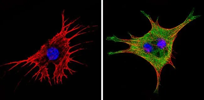ICC/IF analysis of NIH-3T3 cells using GTX54748 eIF1 antibody [2B9]. Cells were probed without (left) or with(right) an antibody. Green : Primary antibody Blue : Nuclei Red : Actin Fixation : Formalin Permeabilization : 0.1% Triton X-100 in TBS for 5-10 minute Dilution : 1:200 incubated overnight at 4 oC
