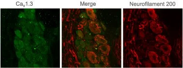 IHC-Fr analysis of rat DRG tissue using GTX54755 Cav1.3 antibody. Staining appears in clusters of cells (green) but not in axons. Staining of neurofilament 200 demonstrates partial overlap with CaV1.3 in neuronal staining but not in axons (red). IHC-Fr analysis of rat DRG tissue using GTX54755 Cav1.3 antibody. Staining appears in clusters of cells (green) but not in axons. Staining of neurofilament 200 demonstrates partial overlap with CaV1.3 in neuronal staining but not in axons (red).