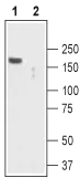 WB analysis of mouse brain tissue lysate using GTX54761 TRPC2 antibody preincubated with or without immunogen peptide. Dilution : 1:200 WB analysis of mouse brain tissue lysate using GTX54761 TRPC2 antibody preincubated with or without immunogen peptide. Dilution : 1:200