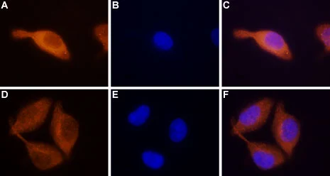 ICC/IF analysis of PFA-fixed RBL cells using GTX54768 STIM2 antibody. Panel A,D : Primary antibody Panel B,E : DNA dye Hoechst 33342 Panel C,F : Merged images of panels A and B Dilution : 1:100 ICC/IF analysis of PFA-fixed RBL cells using GTX54768 STIM2 antibody. Panel A,D : Primary antibody Panel B,E : DNA dye Hoechst 33342 Panel C,F : Merged images of panels A and B Dilution : 1:100