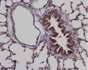 IHC-P analysis of rat lung tissue using GTX54768 STIM2 antibody. Hematoxilin is used as the counterstain. Dilution : 1:100