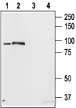 WB analysis of rat brain (lanes 1, 3) and RBL cell (lanes 2, 4) lysates using GTX54768 STIM2 antibody preincubated with or without immunogen peptide. Dilution : 1:200