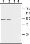 WB analysis of rat (lanes 1 and 3) and mouse (lanes 2 and 4)? brain ?membrane lysates using GTX54771 Cav beta 2 antibody preincubated with or without immunogen peptide. Dilution : 1:800 WB analysis of rat (lanes 1 and 3) and mouse (lanes 2 and 4)? brain ?membrane lysates using GTX54771 Cav beta 2 antibody preincubated with or without immunogen peptide. Dilution : 1:800