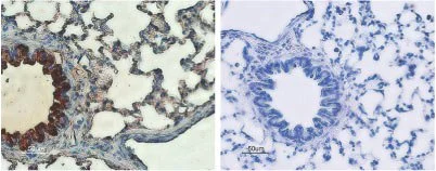 IHC-P analysis of rat lung tissue using GTX54774 CFTR antibody. Strong staining of bronchial epithelial cells (red) and lighter staining of alveolar cells (red-brown) is apparent. There is also positive staining of macrophages while smooth muscle and endothelium are negative. Counterstain of cell nuclei appears blue. A negative control is shown in the right panel. IHC-P analysis of rat lung tissue using GTX54774 CFTR antibody. Strong staining of bronchial epithelial cells (red) and lighter staining of alveolar cells (red-brown) is apparent. There is also positive staining of macrophages while smooth muscle and endothelium are negative. Counterstain of cell nuclei appears blue. A negative control is shown in the right panel.