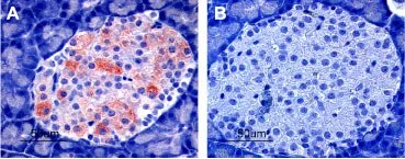 IHC-P analysis of rat pancreas tissue using GTX54777 Kir6.2 antibody. Panel A : Strong granular staining in a number of cells within the Islets of Langerhans is readily detected (red). Panel B : The negative control slide shows no staining. IHC-P analysis of rat pancreas tissue using GTX54777 Kir6.2 antibody. Panel A : Strong granular staining in a number of cells within the Islets of Langerhans is readily detected (red). Panel B : The negative control slide shows no staining.