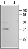 WB analysis of rat pancreas membrane lysate using GTX54777 Kir6.2 antibody preincubated with or without immunogen peptide. Dilution : 1:200