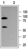 WB analysis of rat brain membrane lysate using GTX54782 Kv7.3 / KCNQ3 antibody preincubated with or without immunogen peptide. Dilution : 1:200 WB analysis of rat brain membrane lysate using GTX54782 Kv7.3 / KCNQ3 antibody preincubated with or without immunogen peptide. Dilution : 1:200
