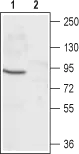 WB analysis of rat eye lysate using GTX54787 CNGA1 antibody preincubated with or without immunogen peptide. Dilution : 1:200