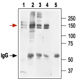 IP analysis of HEK-293 cell lysate using GTX54789 Kv11.1 antibody. Red arrow indicates Kv11.1 while the black arrow shows the IgG heavy chain. WB was performed with the GTX54789 antibody. Lane 1 : Cell lysate Lane 2 : Lysate + protein A beads +?Anti- Kv11.1 ?Antibody? (GTX54785) Lane 3 : Cell lysate + protein A beads +?Anti-Kv11.1 Antibody (GTX54776) Lane 4 : Cell lysate + protein A beads +?Anti-Kv11.1 Antibody (GTX54789) Lane 5 : Cell lysate + protein A beads + pre-immune rabbit serum