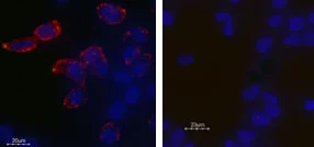 Live cell imaging analysis of live intact HEK-293 transfected cells using GTX54789 Kv11.1 antibody. Left panel : Primary antibody Right panel : Primary antibody preincubated with the negative control antigen Dilution : 1:25