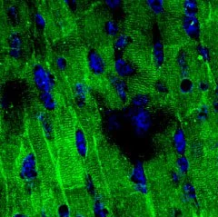 IHC-Fr analysis of mouse heart tissue using GTX54798 Nav1.5 antibody. NaV1.5 staining (green) is part of the striate morphology. Nuclei are stained with DAPI (blue). Dilution : 1:200 IHC-Fr analysis of mouse heart tissue using GTX54798 Nav1.5 antibody. NaV1.5 staining (green) is part of the striate morphology. Nuclei are stained with DAPI (blue). Dilution : 1:200