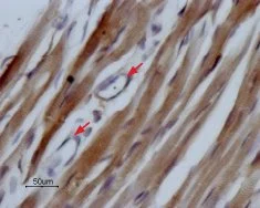 IHC-P analysis of rat heart tissue using GTX54798 Nav1.5 antibody. Staining is specific for cardiomyocytes while smooth muscles cells in the small vessels are negative (red arrows). Hematoxilin is used as the counterstain. Dilution : 1:100