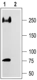 WB analysis of rat heart membrane lysate using GTX54798 Nav1.5 antibody preincubated with or without immunogen peptide. Dilution : 1:200