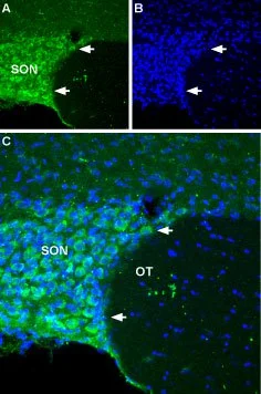 IHC-Fr analysis of rat hypothalamus tissue using GTX54808 NALCN antibody. Panel A : NALCN (green) appears in the supra-optic nucleus (SON). Panel B : DAPI is used as the counterstain (blue). White arrows point at the sharp border between the SON and optic tract (OT). Panel C : Merged images of A and B. IHC-Fr analysis of rat hypothalamus tissue using GTX54808 NALCN antibody. Panel A : NALCN (green) appears in the supra-optic nucleus (SON). Panel B : DAPI is used as the counterstain (blue). White arrows point at the sharp border between the SON and optic tract (OT). Panel C : Merged images of A and B.