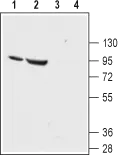 WB analysis of rat (lanes 1 and 3) and mouse (lanes 2 and 4) kidney lysates using GTX54809 ENaC Alpha antibody preincubated with or without immunogen peptide. Dilution : 1:200 WB analysis of rat (lanes 1 and 3) and mouse (lanes 2 and 4) kidney lysates using GTX54809 ENaC Alpha antibody preincubated with or without immunogen peptide. Dilution : 1:200